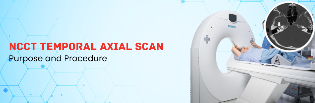 NCCT Temporal Axial Scan: Purpose and Procedure